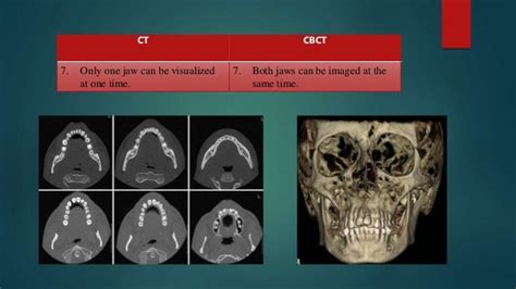cbct vs ct|dental cbct machines comparison.
